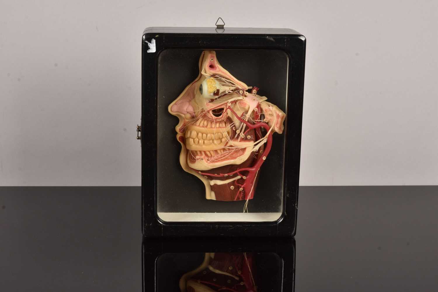 Lot 187 - A Waxwork Cross Section of a Dissected Human Head