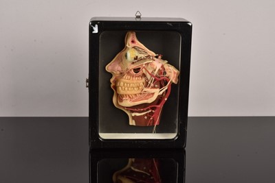 Lot 137 - A Waxwork Cross Section of a Dissected Human Head