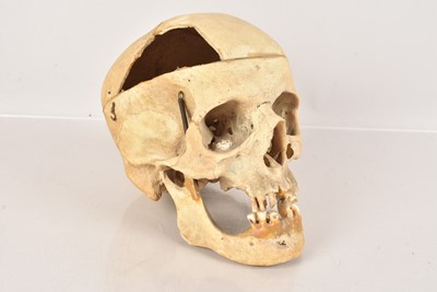 Lot 36 - A 19th Century Human Skull