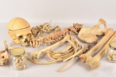 Lot 42 - A Human Skull and Skeleton Parts